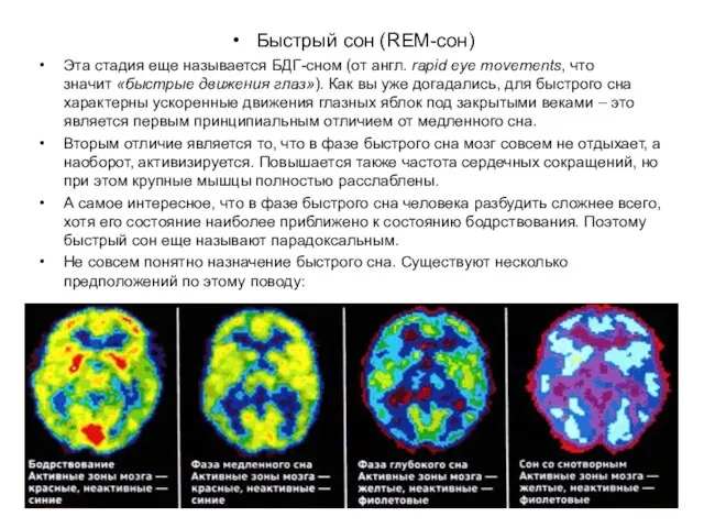 Быстрый сон (REM-сон) Эта стадия еще называется БДГ-сном (от англ. rapid eye