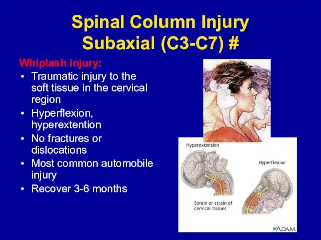 Spinal Column Injury Subaxial (C3-C7) # Whiplash injury: Traumatic injury to the