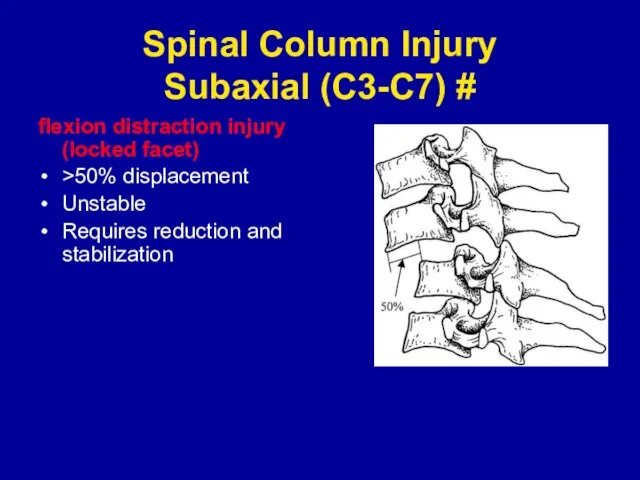 Spinal Column Injury Subaxial (C3-C7) # flexion distraction injury (locked facet) >50%