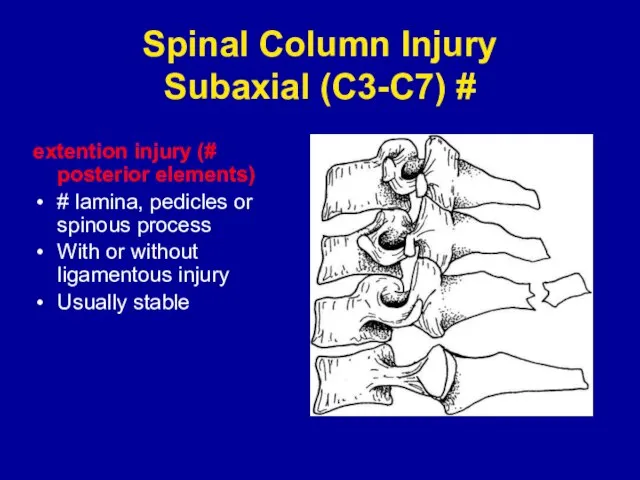 Spinal Column Injury Subaxial (C3-C7) # extention injury (# posterior elements) #