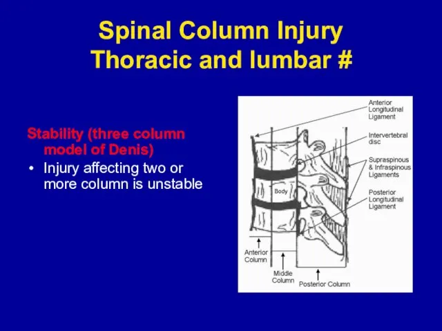 Spinal Column Injury Thoracic and lumbar # Stability (three column model of