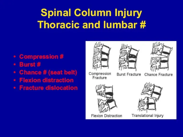 Spinal Column Injury Thoracic and lumbar # Compression # Burst # Chance