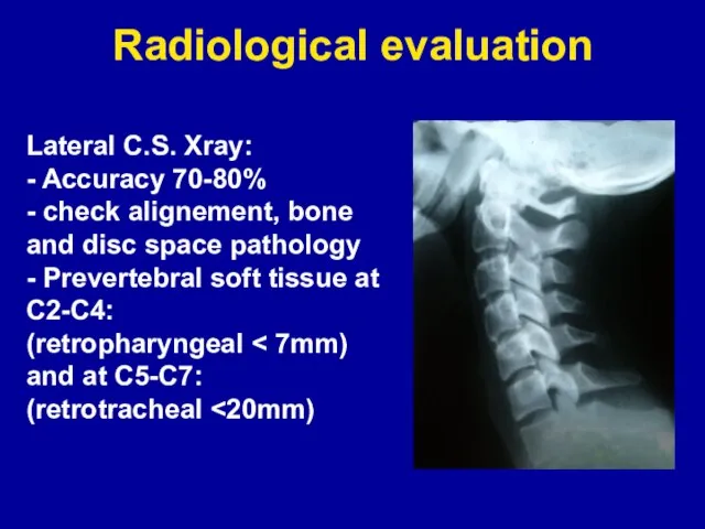 Radiological evaluation Lateral C.S. Xray: - Accuracy 70-80% - check alignement, bone