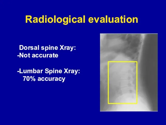 Radiological evaluation Dorsal spine Xray: Not accurate Lumbar Spine Xray: 70% accuracy