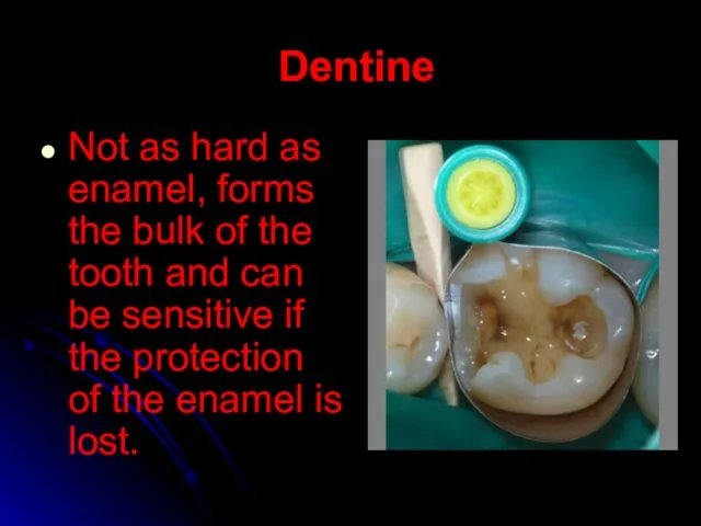 Dentine Not as hard as enamel, forms the bulk of the tooth