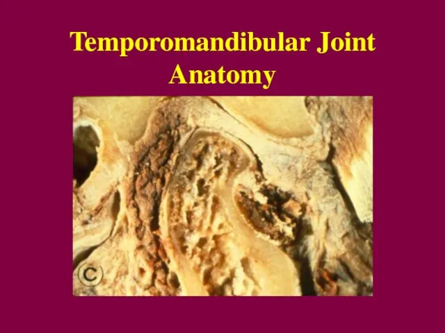 Temporomandibular Joint Anatomy