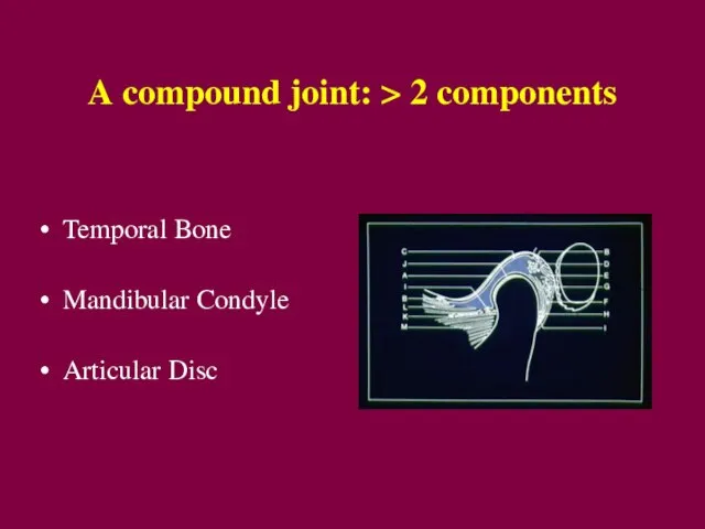 A compound joint: > 2 components Temporal Bone Mandibular Condyle Articular Disc