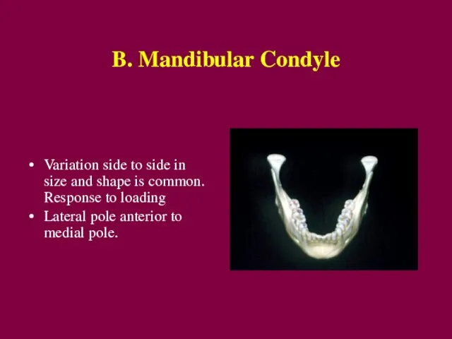 B. Mandibular Condyle Variation side to side in size and shape is