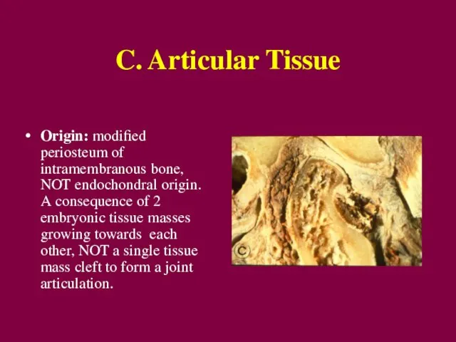 C. Articular Tissue Origin: modified periosteum of intramembranous bone, NOT endochondral origin.