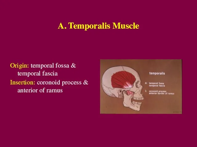 A. Temporalis Muscle Origin: temporal fossa & temporal fascia Insertion: coronoid process & anterior of ramus