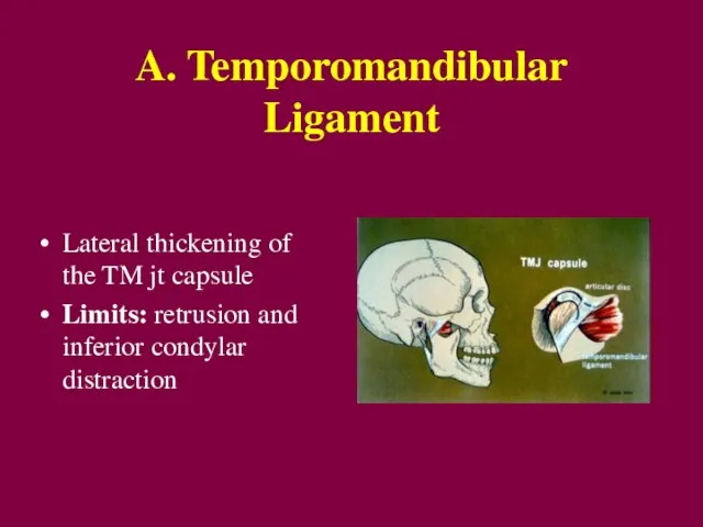 A. Temporomandibular Ligament Lateral thickening of the TM jt capsule Limits: retrusion and inferior condylar distraction