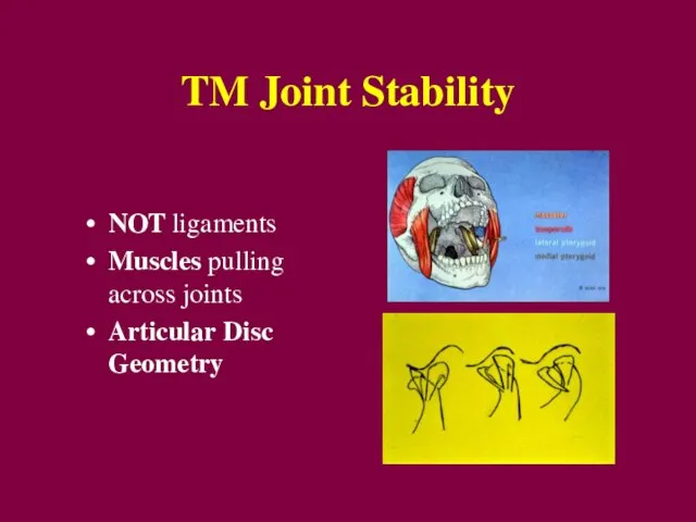 TM Joint Stability NOT ligaments Muscles pulling across joints Articular Disc Geometry