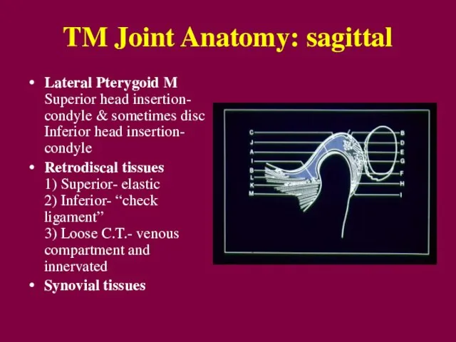 TM Joint Anatomy: sagittal Lateral Pterygoid M Superior head insertion- condyle &