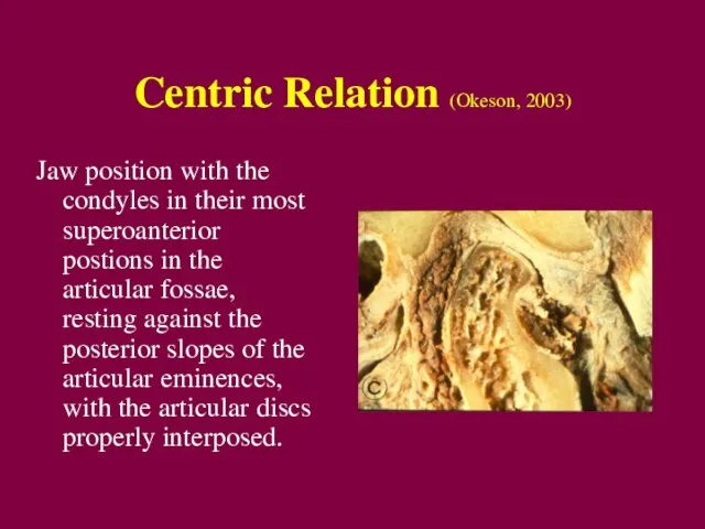 Centric Relation (Okeson, 2003) Jaw position with the condyles in their most