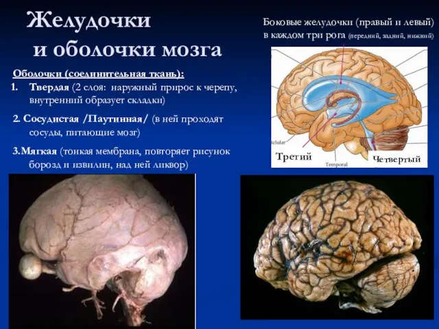 Желудочки и оболочки мозга Боковые желудочки (правый и левый) в каждом три