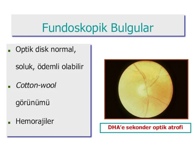 DHA’e sekonder optik atrofi Optik disk normal, soluk, ödemli olabilir Cotton-wool görünümü Hemorajiler Fundoskopik Bulgular