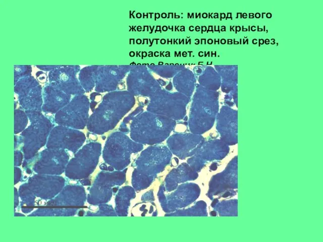 Контроль: миокард левого желудочка сердца крысы, полутонкий эпоновый срез, окраска мет. син. Фото Вареник Е.Н.