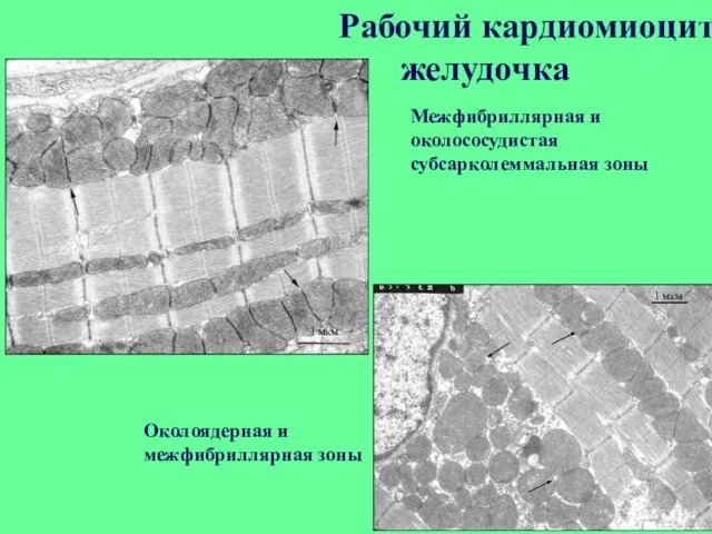 Рабочий кардиомиоцит желудочка Межфибриллярная и околососудистая субсарколеммальная зоны Околоядерная и межфибриллярная зоны 1 мкм 1 мкм