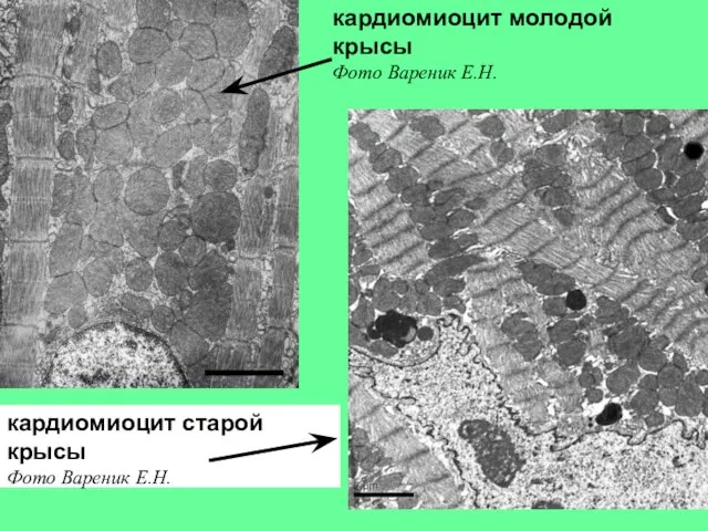 кардиомиоцит молодой крысы Фото Вареник Е.Н. кардиомиоцит старой крысы Фото Вареник Е.Н.