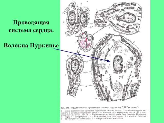 Проводящая система сердца. Волокна Пуркинье