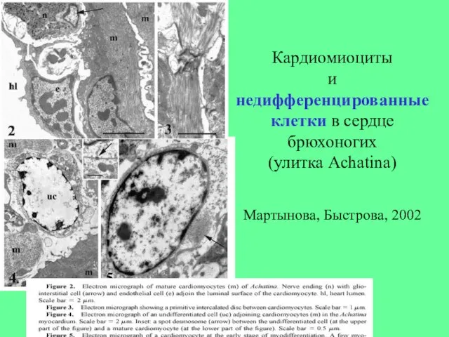 Кардиомиоциты и недифференцированные клетки в сердце брюхоногих (улитка Achatina) Мартынова, Быстрова, 2002