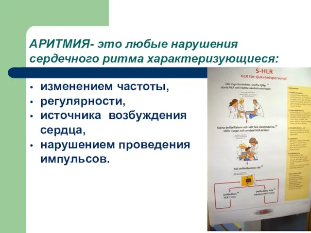 АРИТМИЯ- это любые нарушения сердечного ритма характеризующиеся: изменением частоты, регулярности, источника возбуждения сердца, нарушением проведения импульсов.