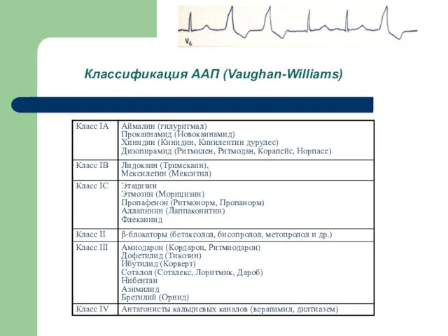 Классификация ААП (Vaughan-Williams)