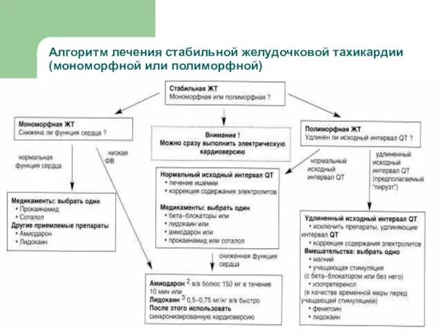 Алгоритм лечения стабильной желудочковой тахикардии (мономорфной или полиморфной)