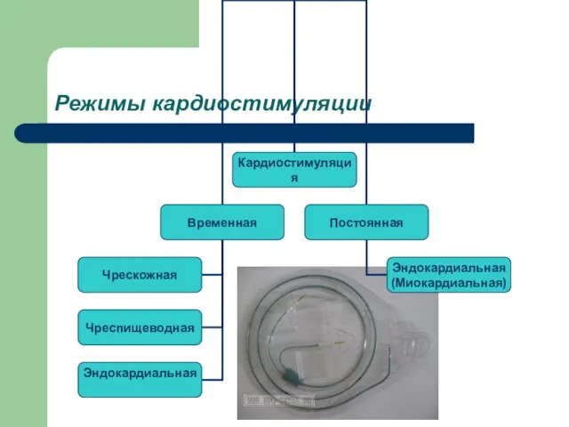 Режимы кардиостимуляции