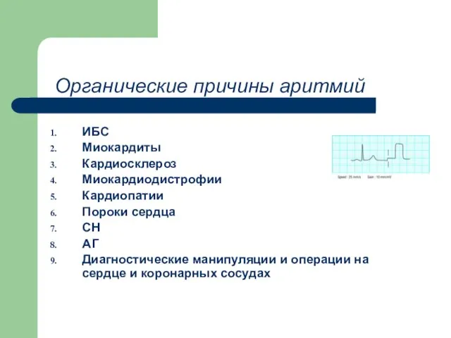 Органические причины аритмий ИБС Миокардиты Кардиосклероз Миокардиодистрофии Кардиопатии Пороки сердца СН АГ