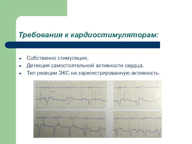 Требования к кардиостимуляторам: Собственно стимуляция, Детекция самостоятельной активности сердца, Тип реакции ЭКС на зарегистрированную активность.