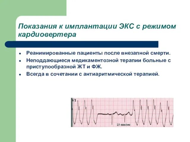 Показания к имплантации ЭКС с режимом кардиовертера Реанимированные пациенты после внезапной смерти.