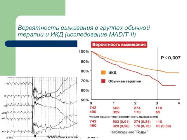 Вероятность выживания в группах обычной терапии и ИКД (исследование MADIТ-II)