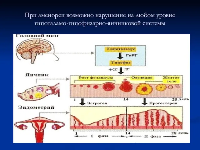 При аменореи возможно нарушение на любом уровне гипоталамо-гипофизарно-яичниковой системы