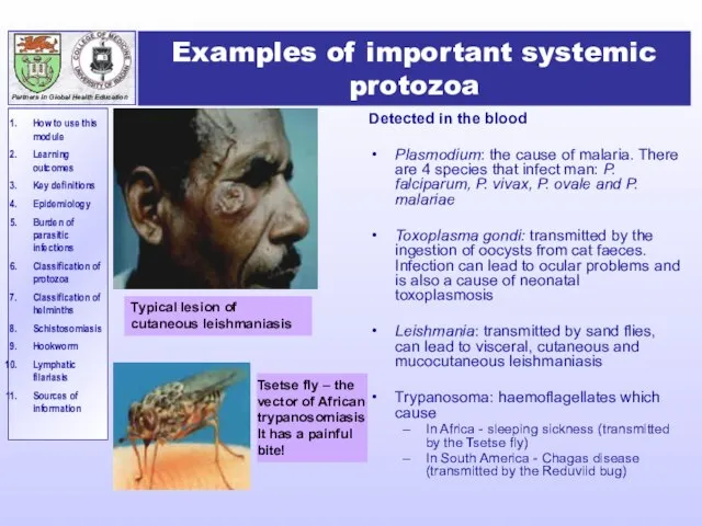 Examples of important systemic protozoa Detected in the blood Plasmodium: the cause