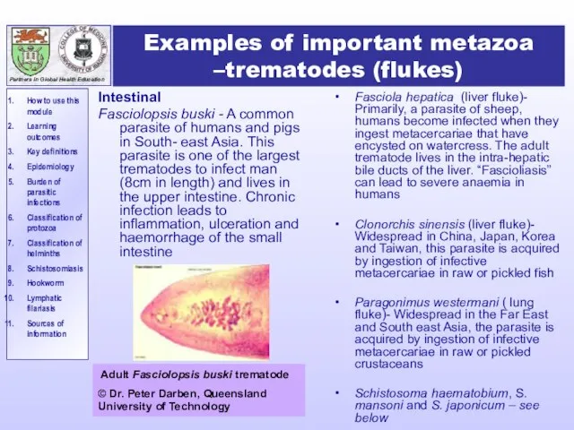 Examples of important metazoa –trematodes (flukes) Intestinal Fasciolopsis buski - A common