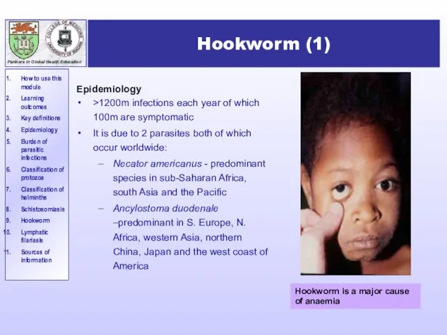 Hookworm (1) Epidemiology >1200m infections each year of which 100m are symptomatic