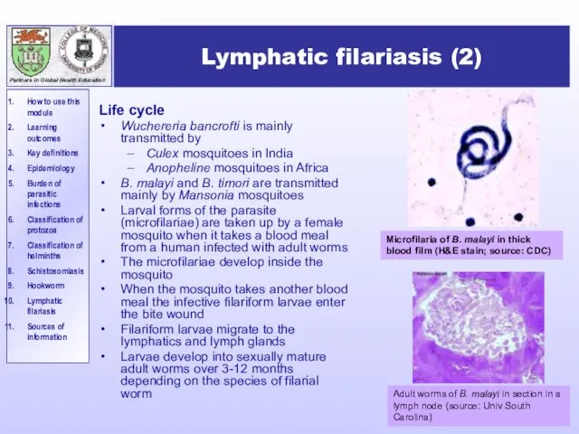 Lymphatic filariasis (2) Life cycle Wuchereria bancrofti is mainly transmitted by Culex