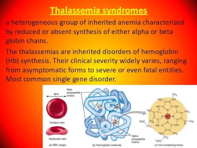 Thalassemia syndromes a heterogeneous group of inherited anemia characterized by reduced or