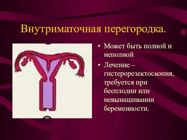 Внутриматочная перегородка. Может быть полной и неполной Лечение – гистерорезектоскопия, требуется при бесплодии или невынашивании беременности.