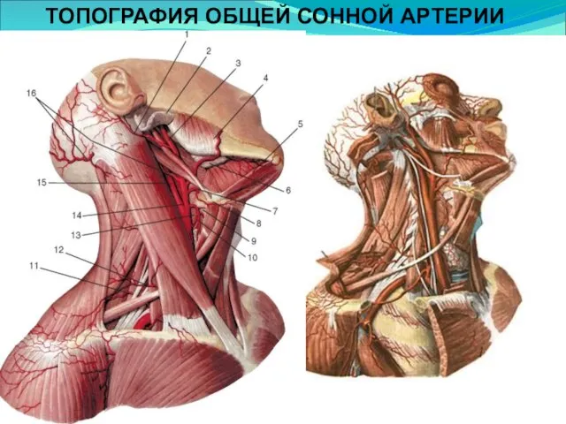 ТОПОГРАФИЯ ОБЩЕЙ СОННОЙ АРТЕРИИ