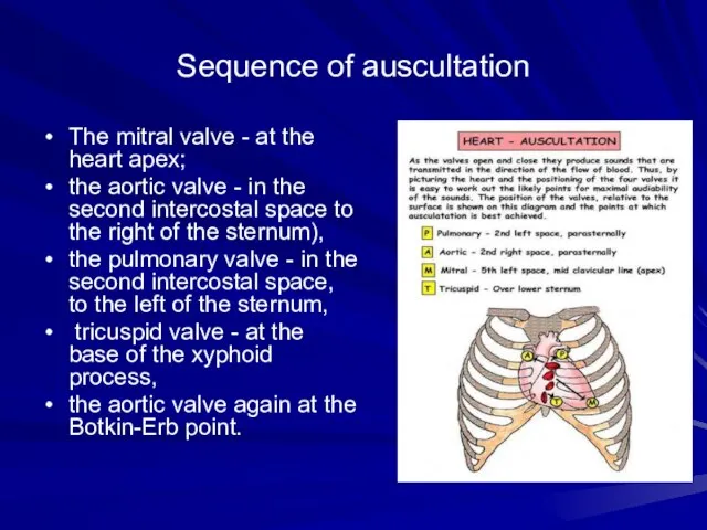 Sequence of auscultation The mitral valve - at the heart apex; the