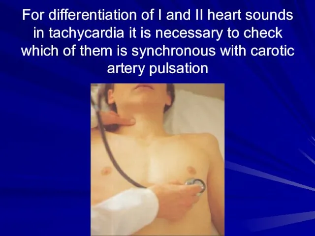 For differentiation of I and II heart sounds in tachycardia it is