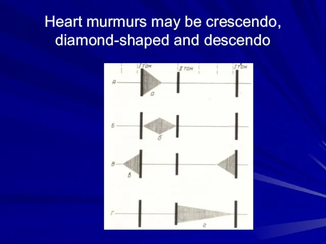 Heart murmurs may be crescendo, diamond-shaped and descendo