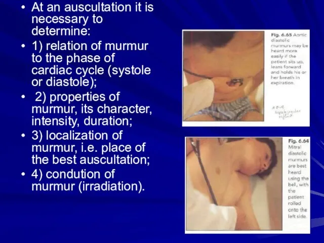 At an auscultation it is necessary to determine: 1) relation of murmur