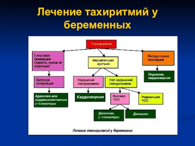 Лечение тахиритмий у беременных