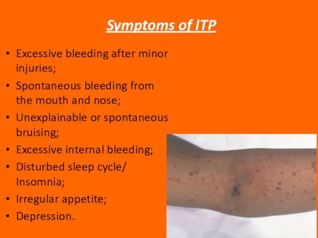 Symptoms of ITP Excessive bleeding after minor injuries; Spontaneous bleeding from the