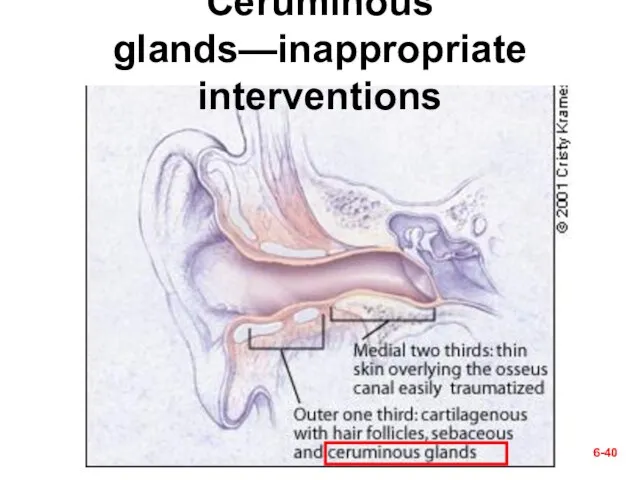 6- Ceruminous glands—inappropriate interventions