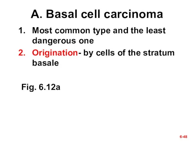 6- 6- A. Basal cell carcinoma Most common type and the least