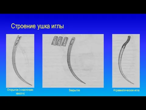 Строение ушка иглы Открытое («ласточкин хвост») Закрытое Атравматическая игла